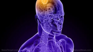 Hope for Alzheimer’s patients: Calcium alpha-ketoglutarate (CaAKG) restores critical memory functions