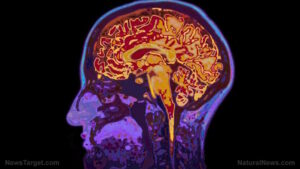 Silent brain inflammation linked to dementia risk, diet and lifestyle offer key defense
